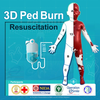 3D PED Burn Resuscitation