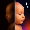 Baby8K: Ultrasound to 8K image