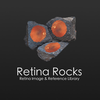 Retina Rocks