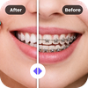 Braces AI Photo Editor