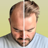 HairCode·Hair Loss Scanner AI