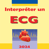 Interpreter un ECG