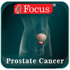 Prostate cancer