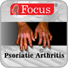 Psoriatic Arthritis