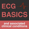 ECG: Basics and Interpretation