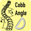 Cobb Angle App