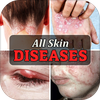 All Skin Diseases & Treatment