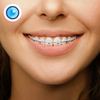 Braces Photo Editor
