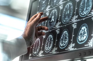 53acf20279be5d5a035aee0c639582a5