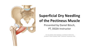 Creative: 8cbdbcf09b94acae8dc4f6feffcbc7b2