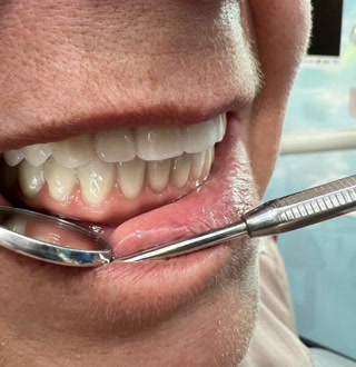 Creative: a23b7f7b894fea43a091961964c3e1fc